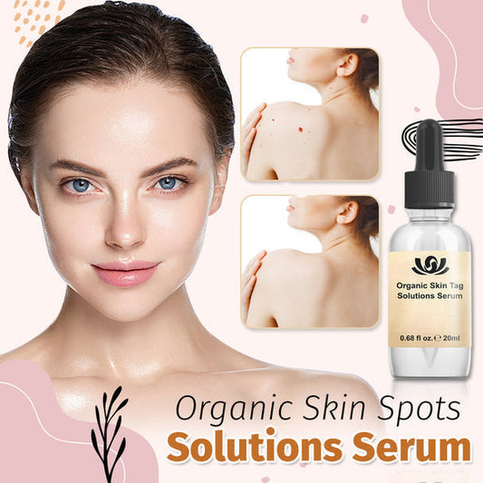 Organic Skin Spot Solutions Serum-【3 Day Delivery&Cash on delivery-HOT SALE-49%OFF🔥】