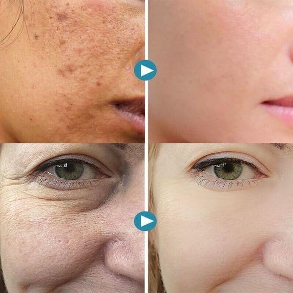 2022 Pore Invisible Cream🔥48% DISCOUNT🔥