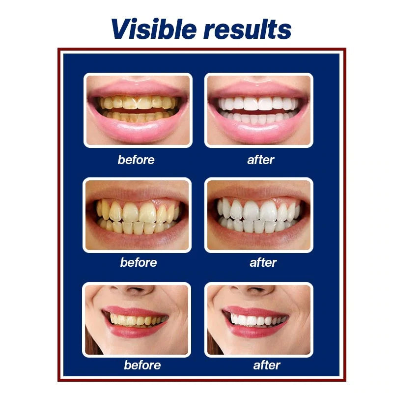 Smile Saver CalculusRemovalSpray【COD + Local Stock !】