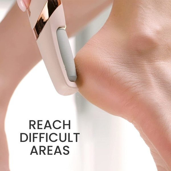 Electric Foot Callus Remover【HOT SALE-45%OFF🔥】