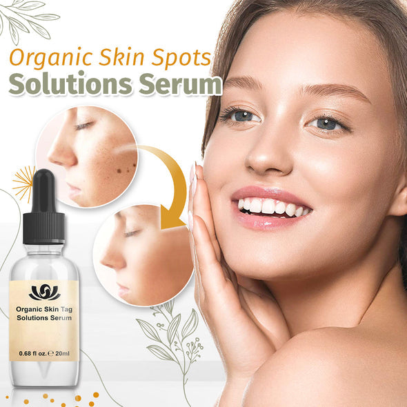 Organic Skin Spot Solutions Serum-【3 Day Delivery&Cash on delivery-HOT SALE-45%OFF🔥】