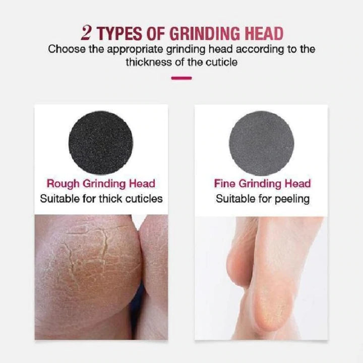 ELECTRIC FOOT FILE VACUUM CALLUS REMOVER【🇮🇳COD + Local Stock ！！!】