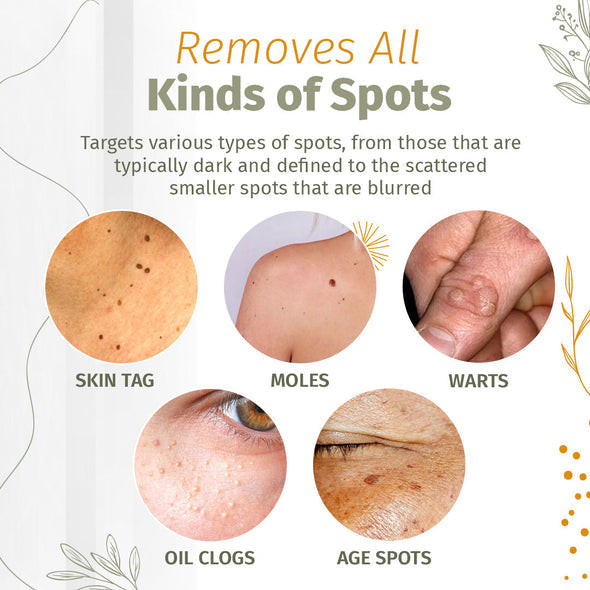 Organic Skin Spot Solutions Serum-【3 Day Delivery&Cash on delivery-HOT SALE-49%OFF🔥】