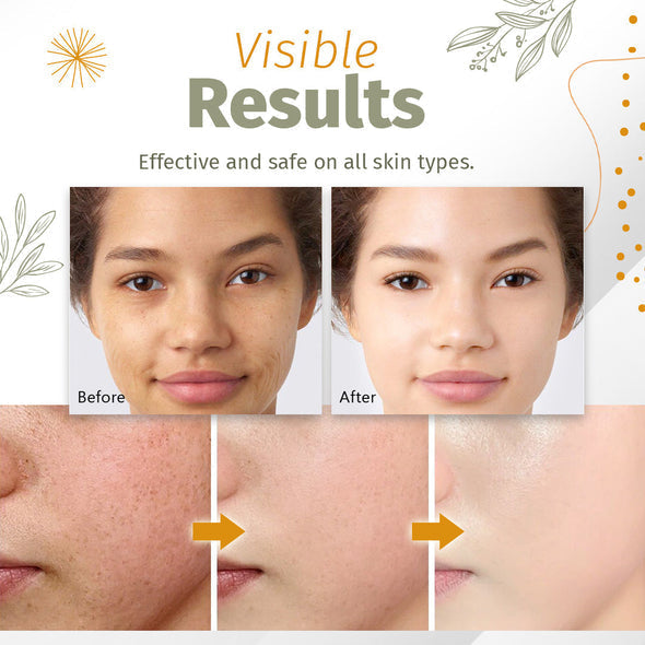 Organic Skin Spot Solutions Serum-【3 Day Delivery&Cash on delivery-HOT SALE-49%OFF🔥】