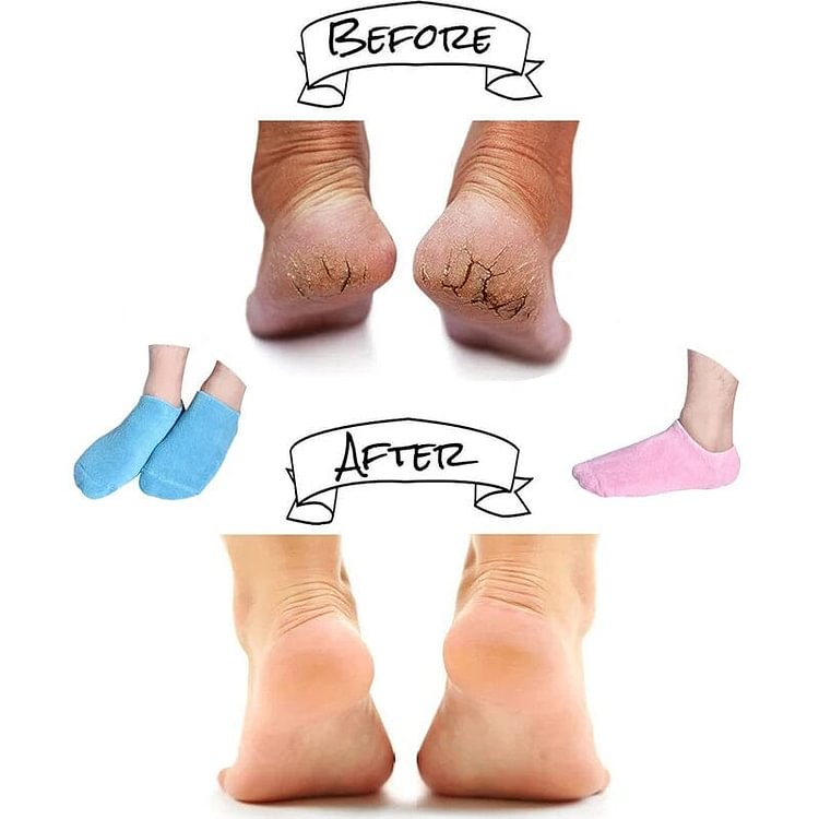 Moisturizing Socks with Gel Lining【HOT SALE-48%OFF🔥🔥🔥🔥🔥】