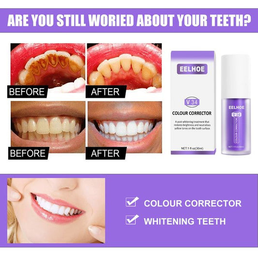 🔥Hot Sale-Dental Color Corrector【3 Day Delivery&Cash on delivery-HOT SALE-45%OFF🔥】