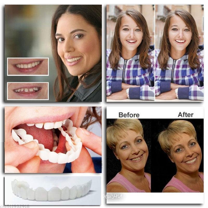 The latest sixth generation of adjustable snap-on dentures (2023 Edition)【🎌From Japan🎌】