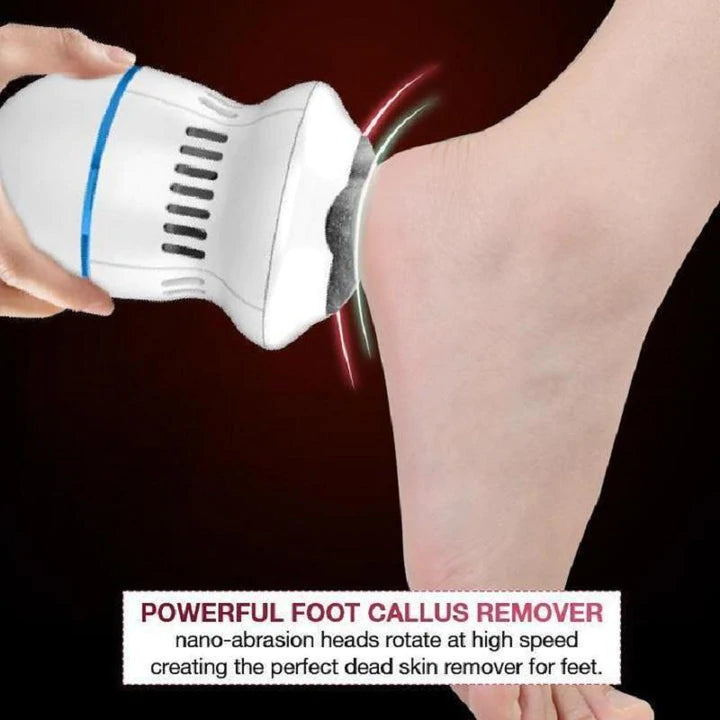 ELECTRIC FOOT FILE VACUUM CALLUS REMOVER【🇮🇳COD + Local Stock ！！!】