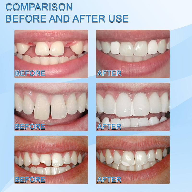 Latest👨‍⚕Tooth Repair Granules😁 (💥48% OFF) - 🔥HOT SALE🔥🎉 【🇮🇳COD + Local Stock ！！!】【Invalid refund】
